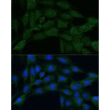 Immunofluorescence - Anti-MTHFD2 Antibody (A11302) - Antibodies.com