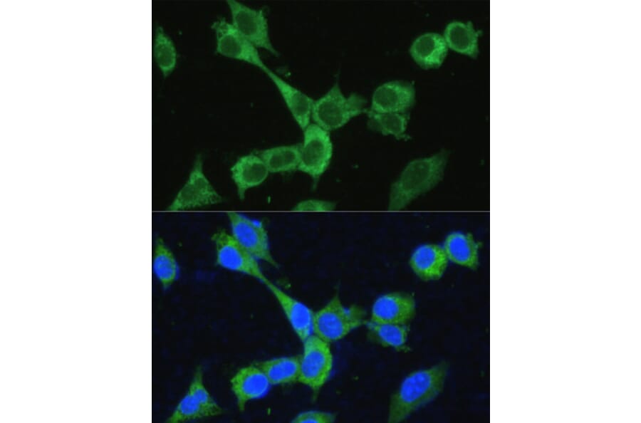Immunofluorescence - Anti-MTHFD2 Antibody (A11302) - Antibodies.com