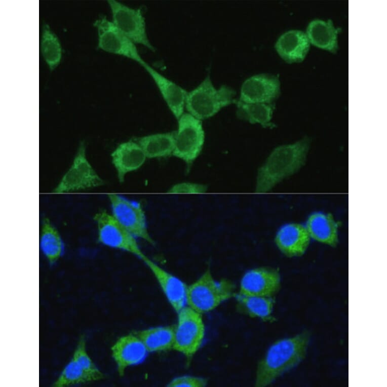 Immunofluorescence - Anti-MTHFD2 Antibody (A11302) - Antibodies.com