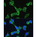 Immunofluorescence - Anti-MTHFD2 Antibody (A11302) - Antibodies.com