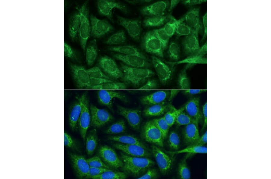 Immunofluorescence - Anti-MTHFD2 Antibody (A11302) - Antibodies.com