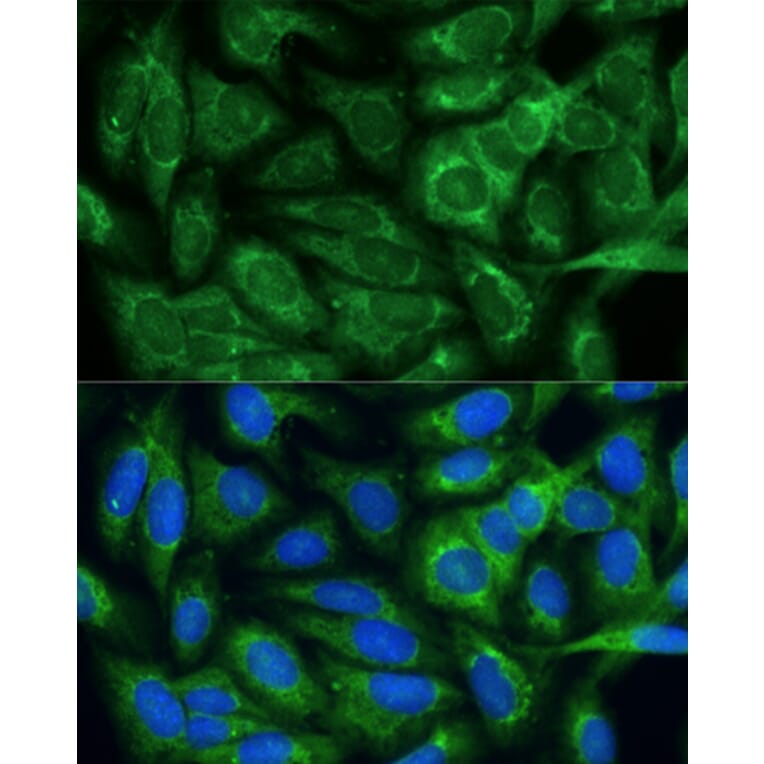 Immunofluorescence - Anti-MTHFD2 Antibody (A11302) - Antibodies.com