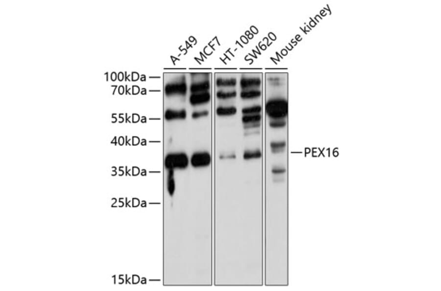 Western Blot - Anti-PEX16 Antibody (A10387) - Antibodies.com
