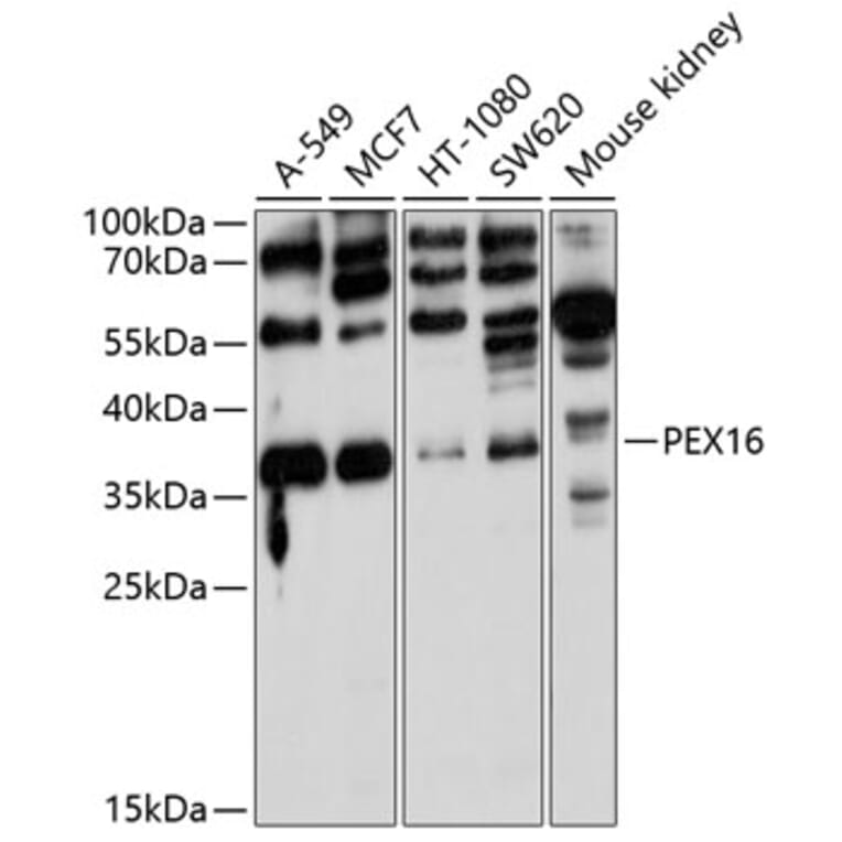 Western Blot - Anti-PEX16 Antibody (A10387) - Antibodies.com