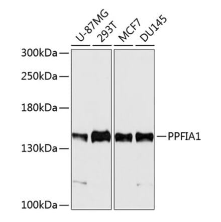 Western Blot - Anti-PPFIA1 Antibody (A11304) - Antibodies.com