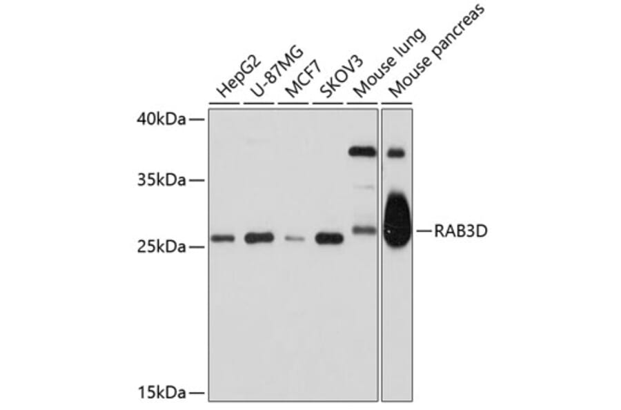 Western Blot - Anti-Rab3D Antibody (A11305) - Antibodies.com