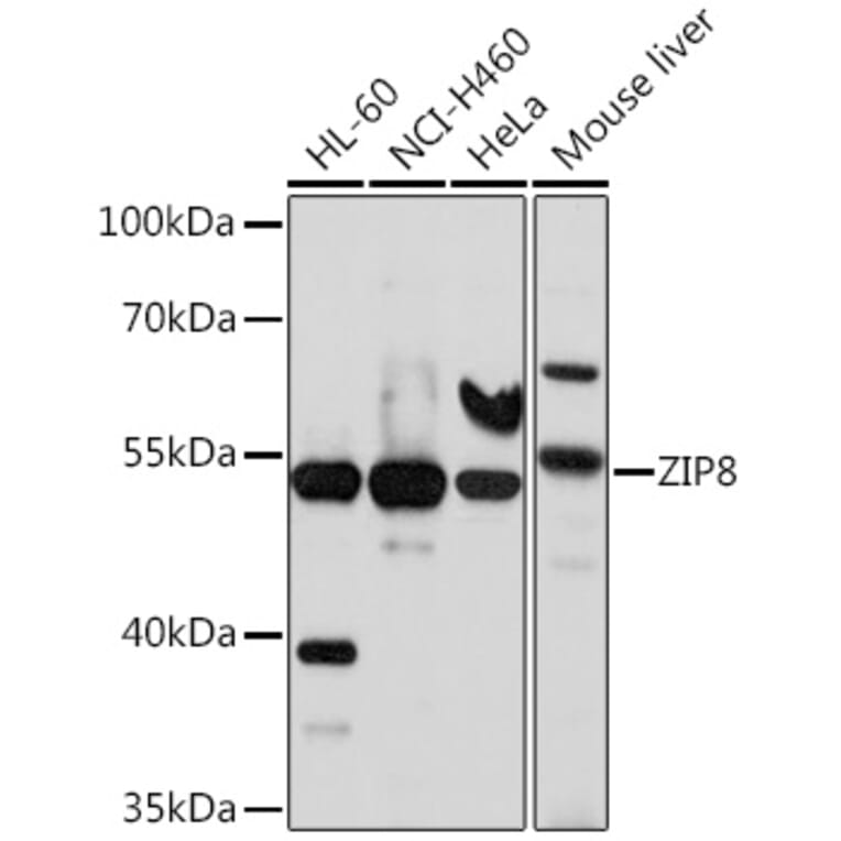 Western Blot - Anti-SLC39A8 Antibody (A11306) - Antibodies.com