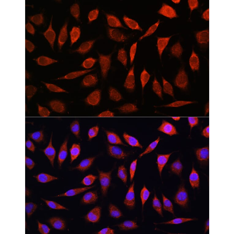 Immunofluorescence - Anti-SLC39A8 Antibody (A11306) - Antibodies.com