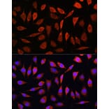 Immunofluorescence - Anti-SLC39A8 Antibody (A11306) - Antibodies.com