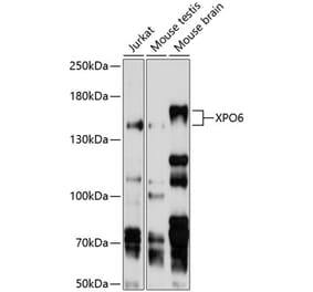 Western Blot - Anti-XPO6 Antibody (A11307) - Antibodies.com