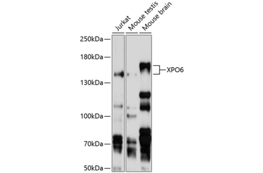 Western Blot - Anti-XPO6 Antibody (A11307) - Antibodies.com