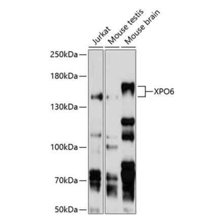 Western Blot - Anti-XPO6 Antibody (A11307) - Antibodies.com