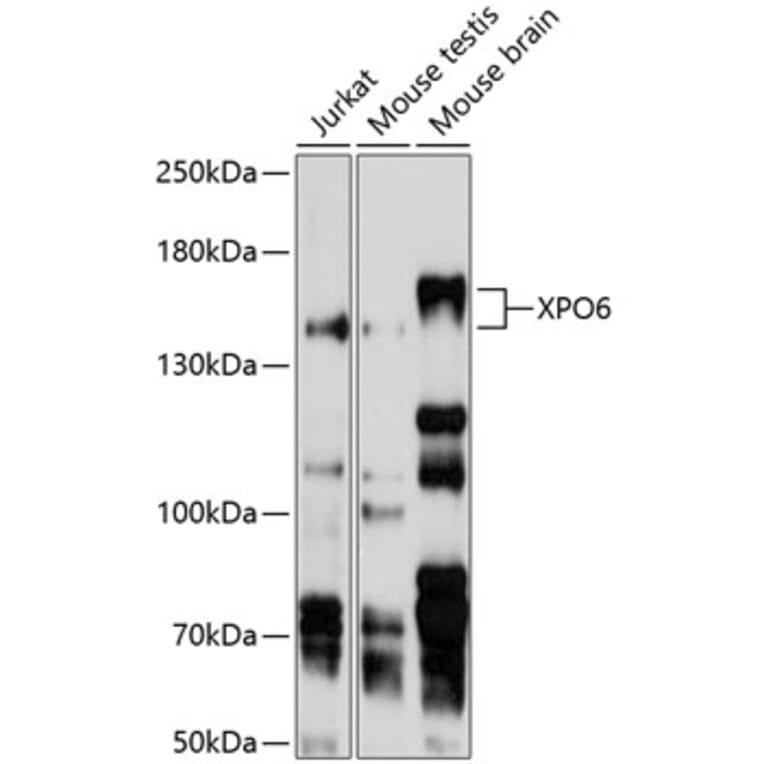 Western Blot - Anti-XPO6 Antibody (A11307) - Antibodies.com