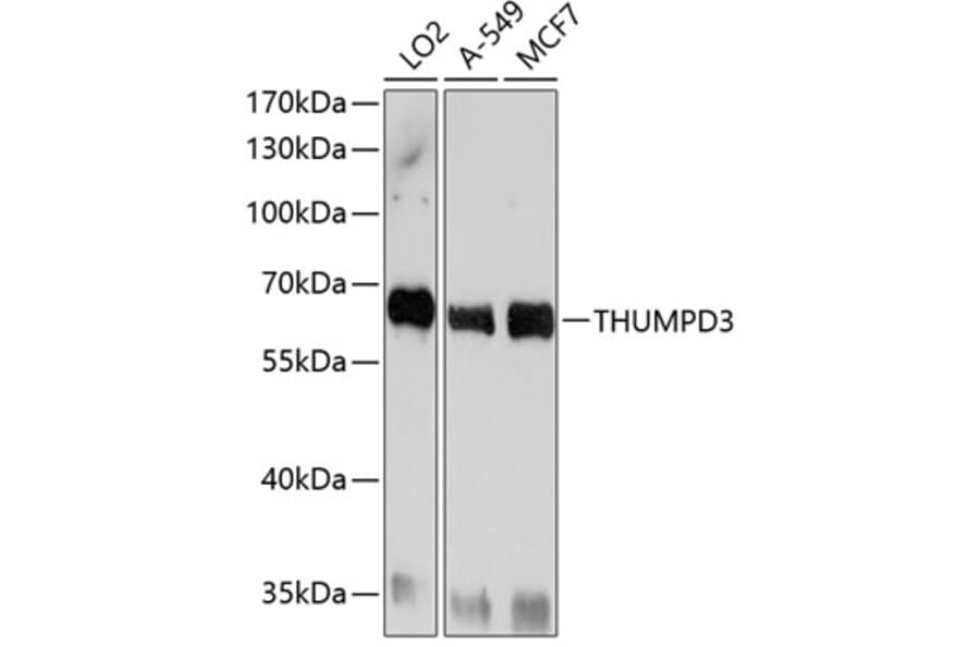 Western Blot - Anti-THUMPD3 Antibody (A11309) - Antibodies.com