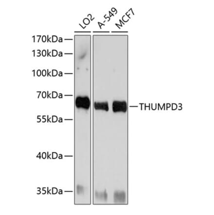 Western Blot - Anti-THUMPD3 Antibody (A11309) - Antibodies.com