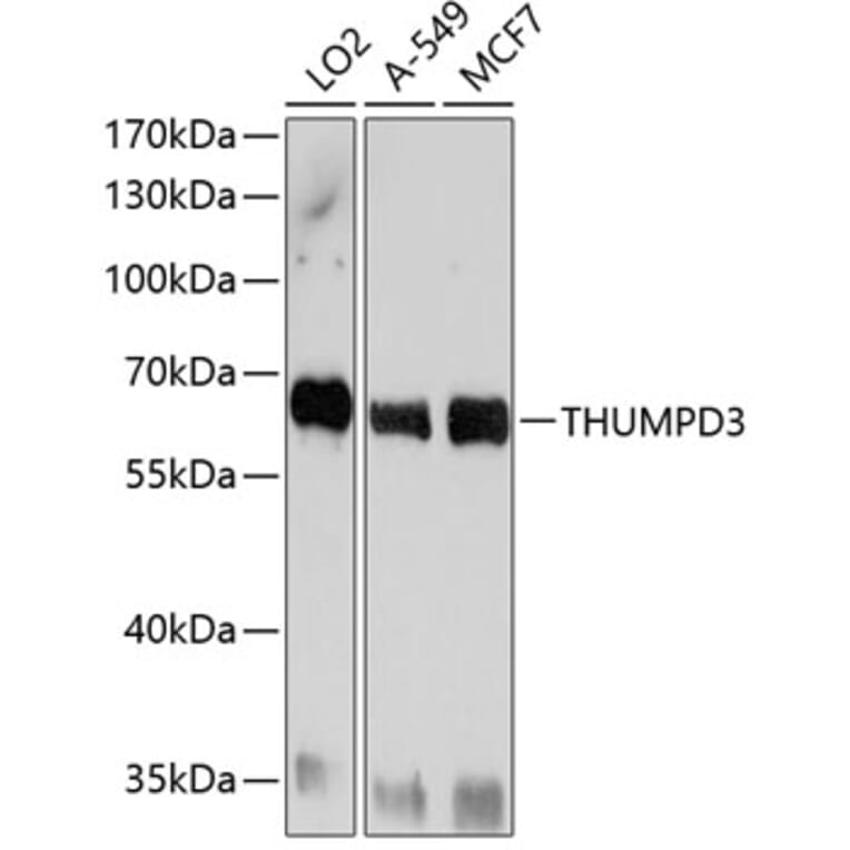 Western Blot - Anti-THUMPD3 Antibody (A11309) - Antibodies.com