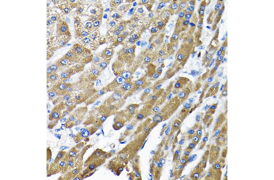Immunohistochemistry - Anti-THUMPD3 Antibody (A11309) - Antibodies.com