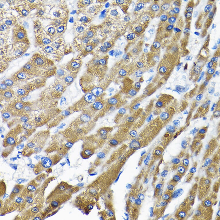 Immunohistochemistry - Anti-THUMPD3 Antibody (A11309) - Antibodies.com