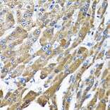 Immunohistochemistry - Anti-THUMPD3 Antibody (A11309) - Antibodies.com