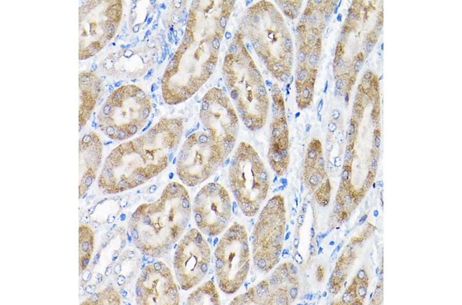 Immunohistochemistry - Anti-THUMPD3 Antibody (A11309) - Antibodies.com