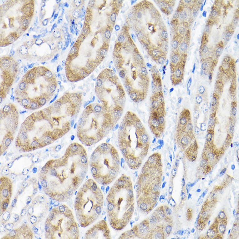 Immunohistochemistry - Anti-THUMPD3 Antibody (A11309) - Antibodies.com
