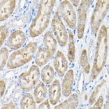 Immunohistochemistry - Anti-THUMPD3 Antibody (A11309) - Antibodies.com