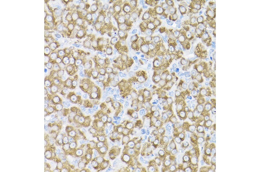 Immunohistochemistry - Anti-THUMPD3 Antibody (A11309) - Antibodies.com