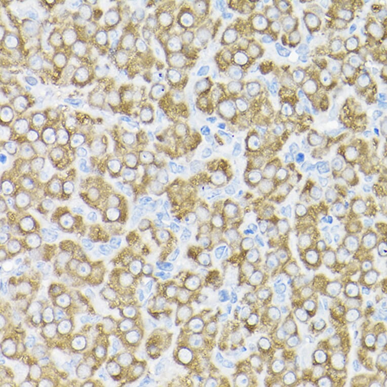 Immunohistochemistry - Anti-THUMPD3 Antibody (A11309) - Antibodies.com