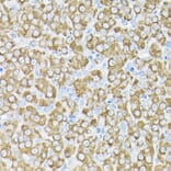 Immunohistochemistry - Anti-THUMPD3 Antibody (A11309) - Antibodies.com