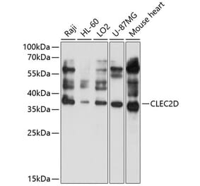 Western Blot - Anti-CLEC2D Antibody (A11310) - Antibodies.com
