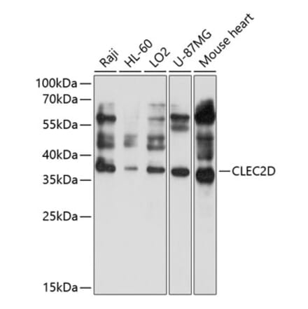 Western Blot - Anti-CLEC2D Antibody (A11310) - Antibodies.com