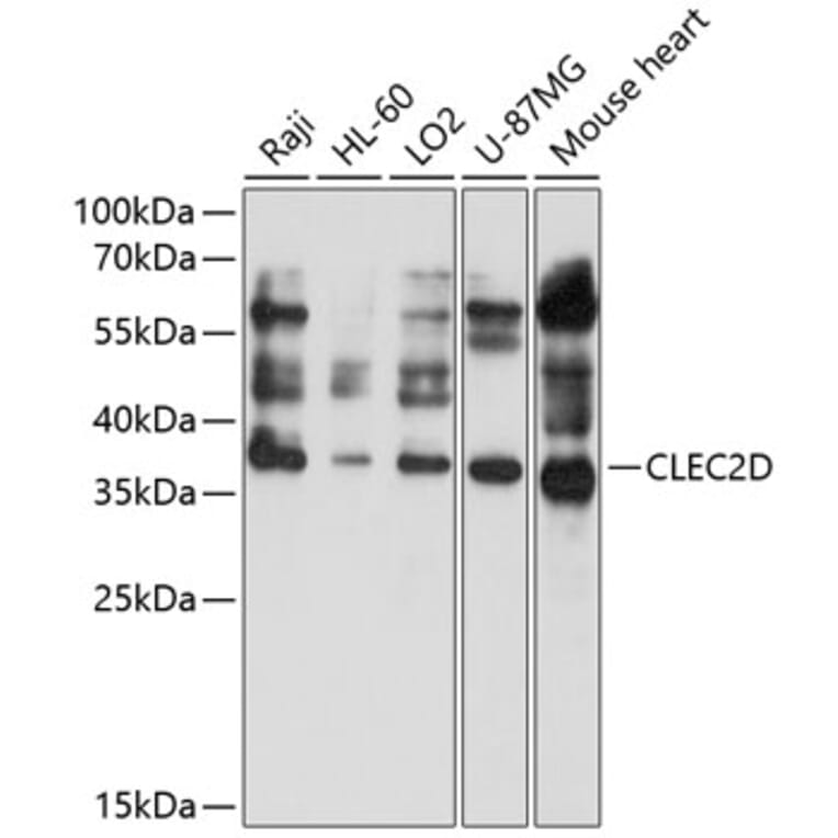 Western Blot - Anti-CLEC2D Antibody (A11310) - Antibodies.com