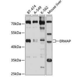 Western Blot - Anti-ERMAP Antibody (A11311) - Antibodies.com