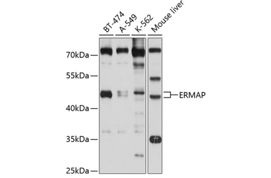 Western Blot - Anti-ERMAP Antibody (A11311) - Antibodies.com