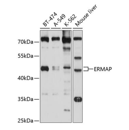 Western Blot - Anti-ERMAP Antibody (A11311) - Antibodies.com