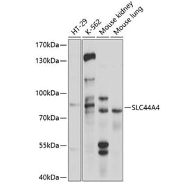 Western Blot - Anti-SLC44A4 Antibody (A11312) - Antibodies.com
