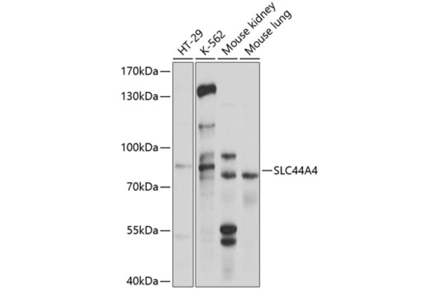 Western Blot - Anti-SLC44A4 Antibody (A11312) - Antibodies.com