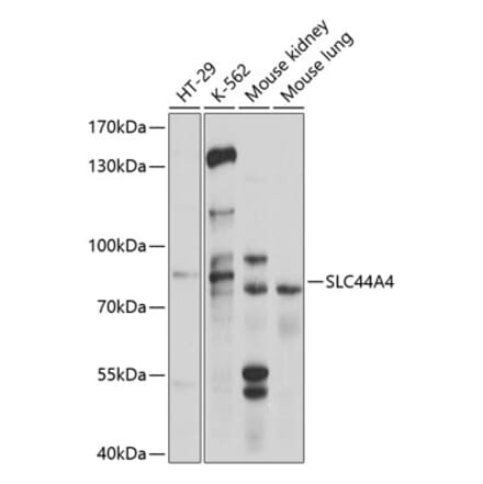 Western Blot - Anti-SLC44A4 Antibody (A11312) - Antibodies.com