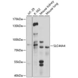 Western Blot - Anti-SLC44A4 Antibody (A11312) - Antibodies.com