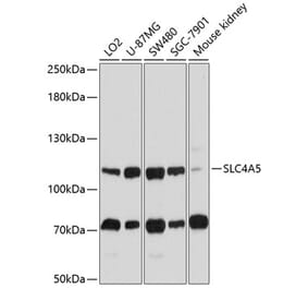 Western Blot - Anti-SLC4A5 Antibody (A11313) - Antibodies.com