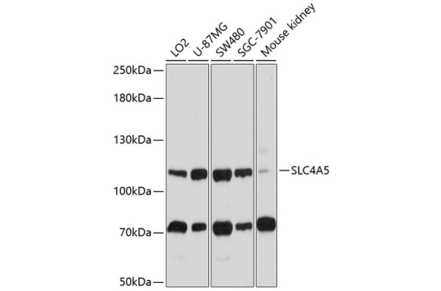 Western Blot - Anti-SLC4A5 Antibody (A11313) - Antibodies.com