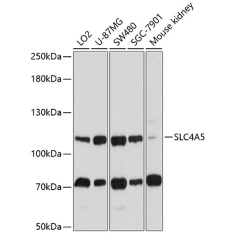 Western Blot - Anti-SLC4A5 Antibody (A11313) - Antibodies.com
