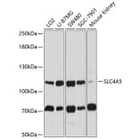Western Blot - Anti-SLC4A5 Antibody (A11313) - Antibodies.com