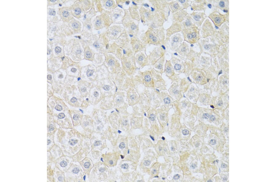 Immunohistochemistry - Anti-SLC4A5 Antibody (A11313) - Antibodies.com