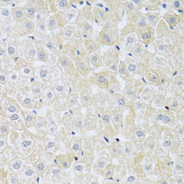 Immunohistochemistry - Anti-SLC4A5 Antibody (A11313) - Antibodies.com