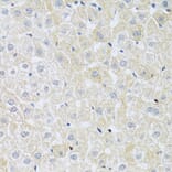 Immunohistochemistry - Anti-SLC4A5 Antibody (A11313) - Antibodies.com