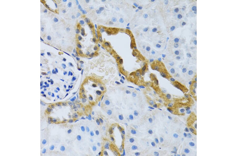 Immunohistochemistry - Anti-SLC4A5 Antibody (A11313) - Antibodies.com