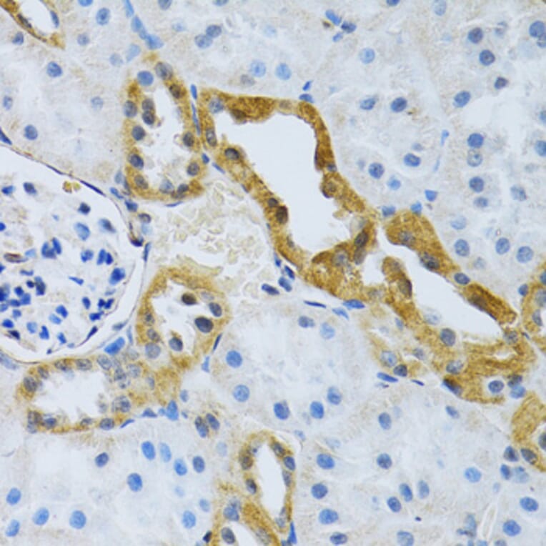 Immunohistochemistry - Anti-SLC4A5 Antibody (A11313) - Antibodies.com