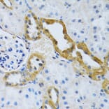 Immunohistochemistry - Anti-SLC4A5 Antibody (A11313) - Antibodies.com