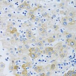 Immunohistochemistry - Anti-SLC4A5 Antibody (A11313) - Antibodies.com